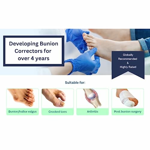 Image showing bunion corrector uses and benefits for various foot conditions