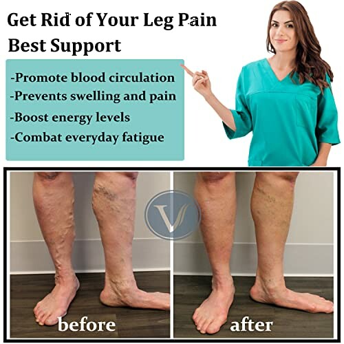 Before and after images showing leg pain relief and improved appearance.